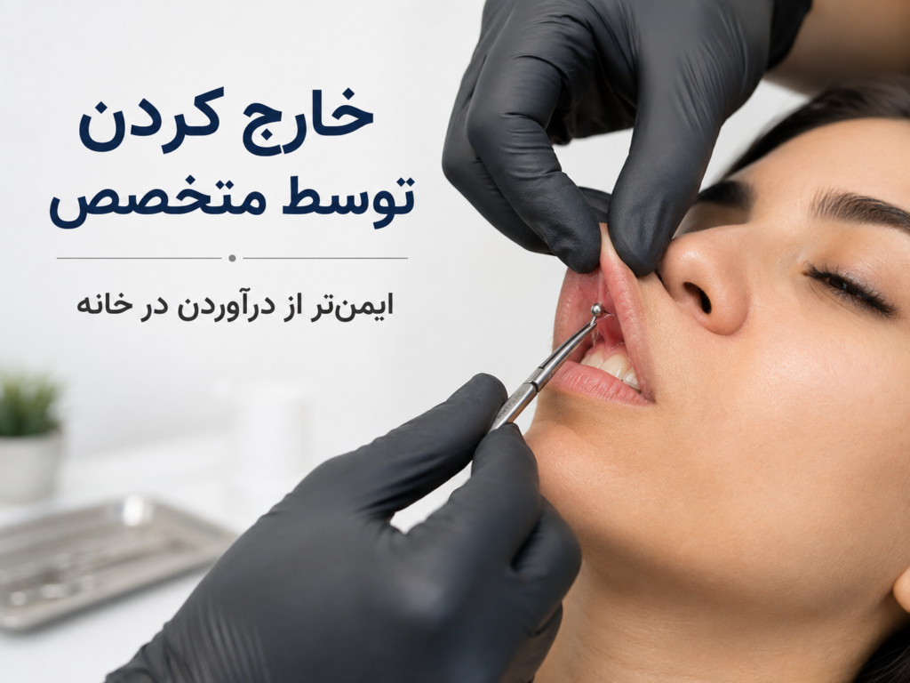 درآوردن جواهر پیرسینگ اسمایل توسط متخصص پیرسینگ