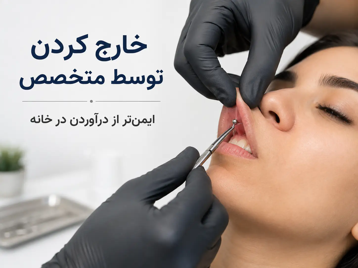 درآوردن جواهر پیرسینگ اسمایل توسط متخصص پیرسینگ