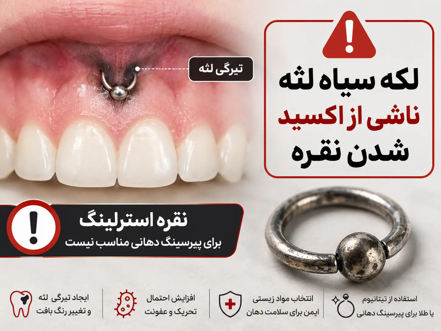 پیرسینگ اسمایل روی فرنولوم لب بالا با نمای نزدیک