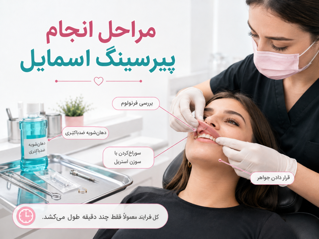 مراحل انجام پیرسینگ اسمایل توسط پیرسر حرفه‌ای
