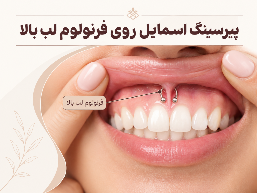 نمای نزدیک از پیرسینگ اسمایل روی فرنولوم لب بالا