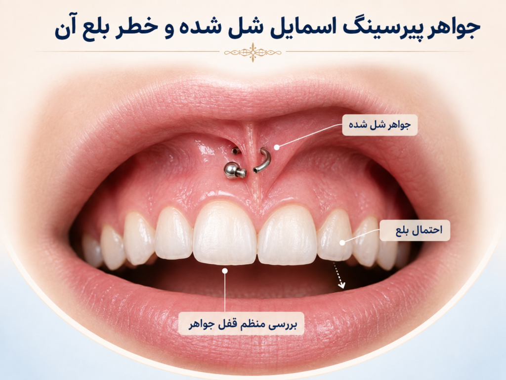 جواهر پیرسینگ اسمایل شل شده و خطر بلع آن