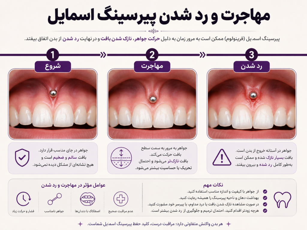 فرآیند مهاجرت و ردشدن احتمالی پیرسینگ اسمایل با گذر زمان