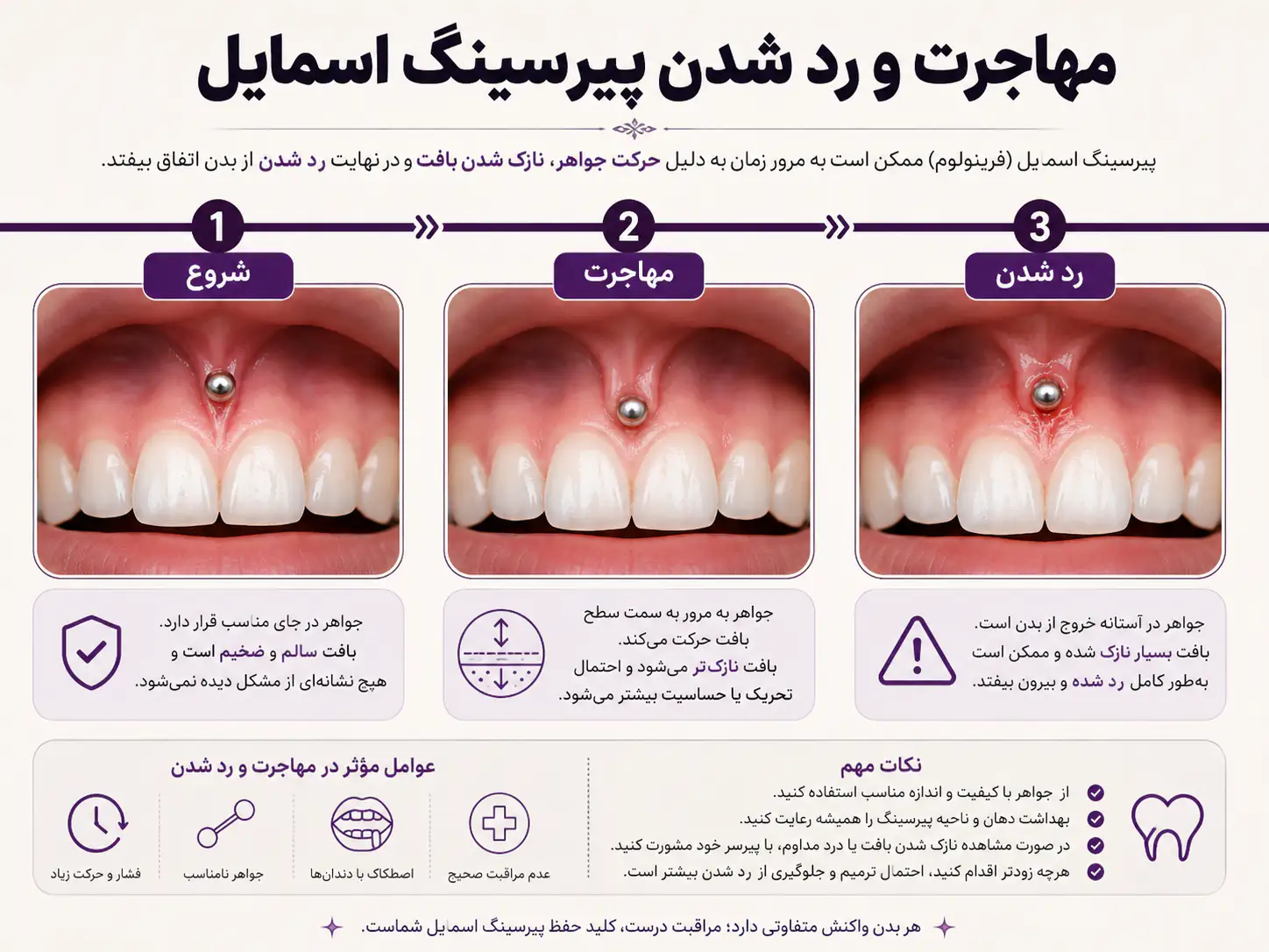 فرآیند مهاجرت و ردشدن احتمالی پیرسینگ اسمایل با گذر زمان