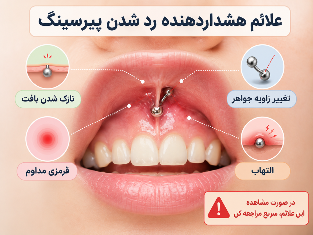علائم هشداردهنده رد شدن پیرسینگ اسمایل