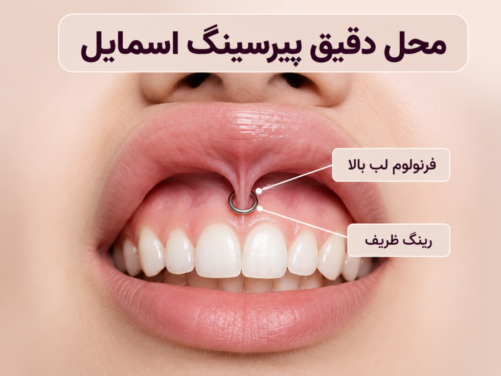 محل دقیق پیرسینگ اسمایل روی فرنولوم لب بالا