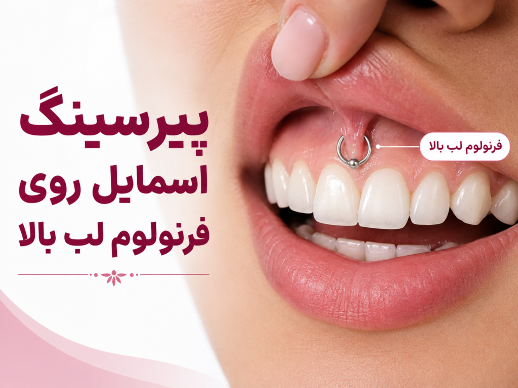 لکه سیاه روی لثه ناشی از اکسید شدن نقره در پیرسینگ دهانی
