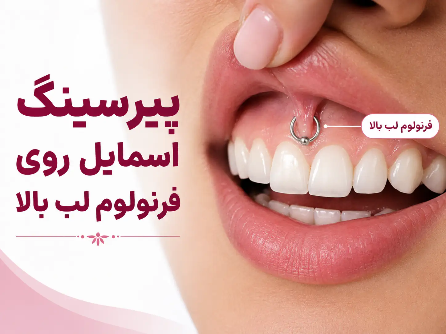 لکه سیاه روی لثه ناشی از اکسید شدن نقره در پیرسینگ دهانی