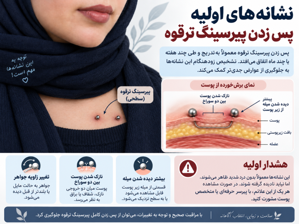 میله پیرسینگ ترقوه که به دلیل پس زدن پیشرفته بیشتر از حالت طبیعی از زیر پوست بیرون زده