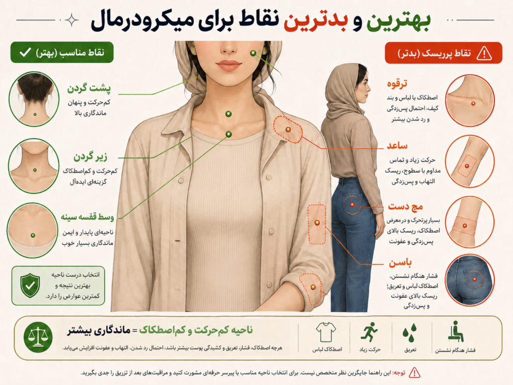 مقایسه بهترین و بدترین نقاط بدن برای پیرسینگ میکرودرمال