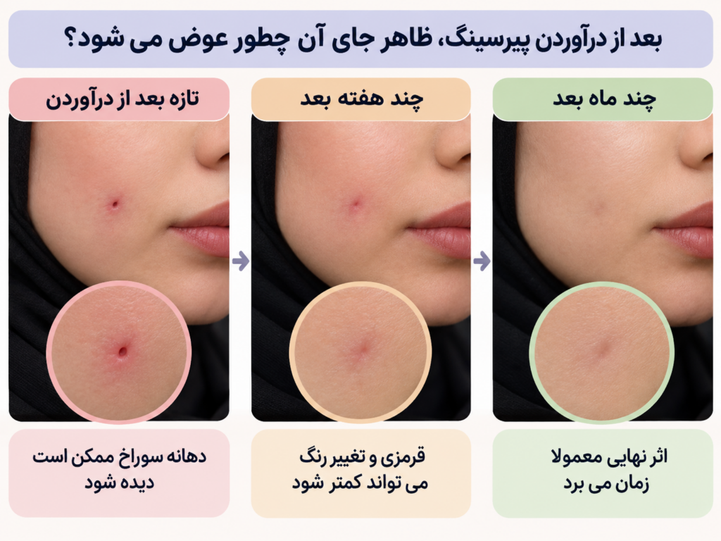 تغییر ظاهر جای پیرسینگ گونه از سوراخ تازه بسته شده تا اثر کم‌رنگ‌تر پس از ترمیم