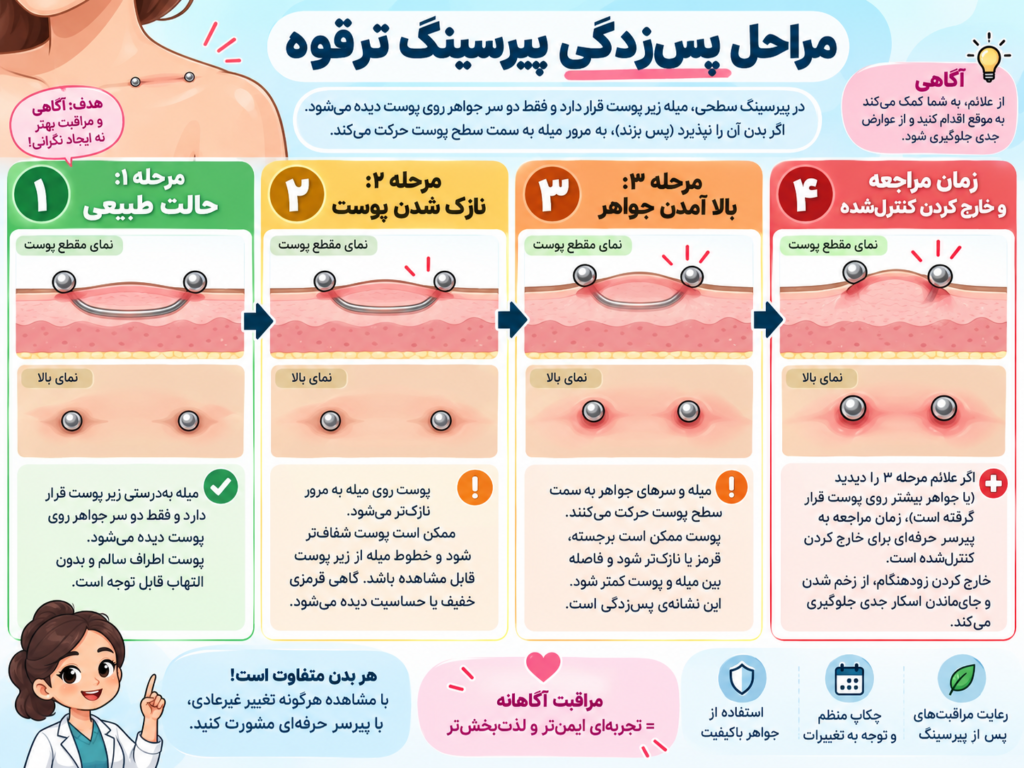 مراحل پس زدگی جواهر پیرسینگ سطحی ترقوه توسط بدن
