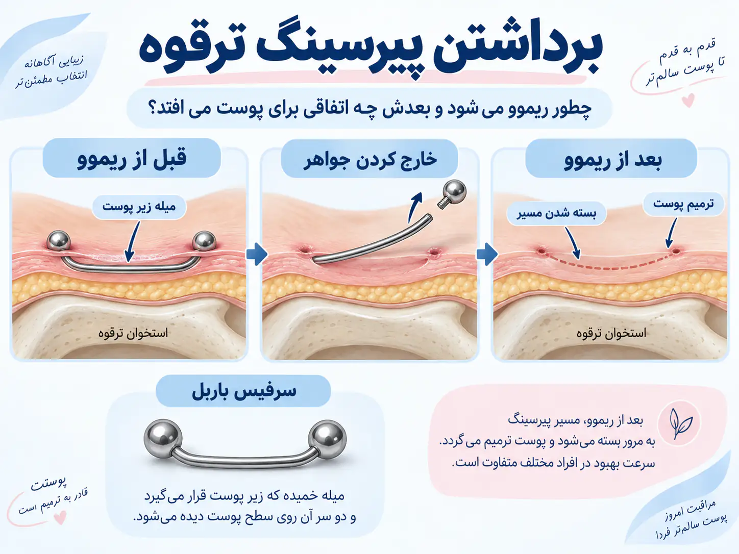 برداشتن پیرسینگ ترقوه؛ چطور ریموو می‌شه و بعدش چه اتفاقی برای پوست می‌افته؟