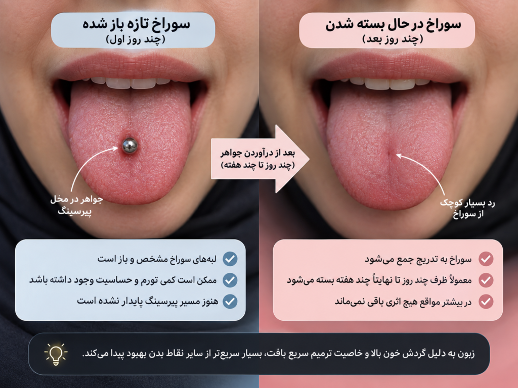 ریتینر شفاف مخصوص زبان برای نگه داشتن سوراخ پیرسینگ باز