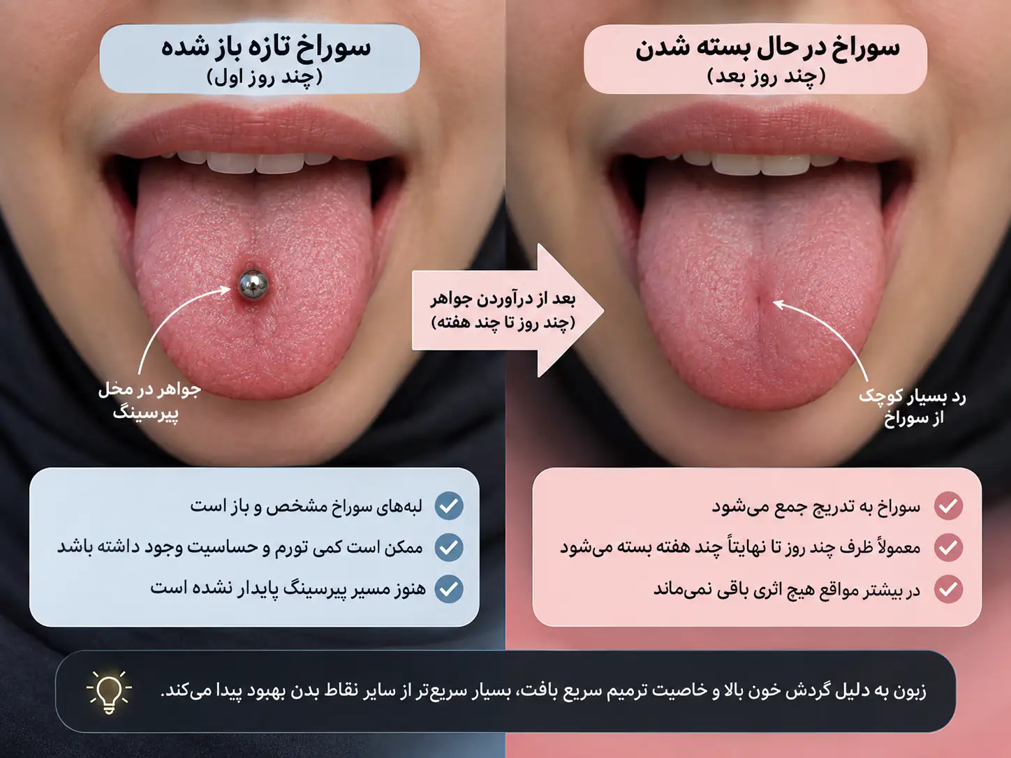 ریتینر شفاف مخصوص زبان برای نگه داشتن سوراخ پیرسینگ باز