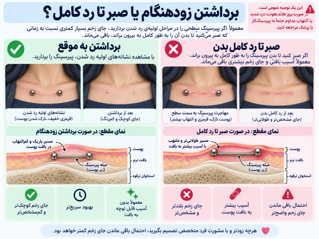 مقایسه‌ی جای زخم پیرسینگ ترقوه در برداشتن زودهنگام و رد کامل بدن