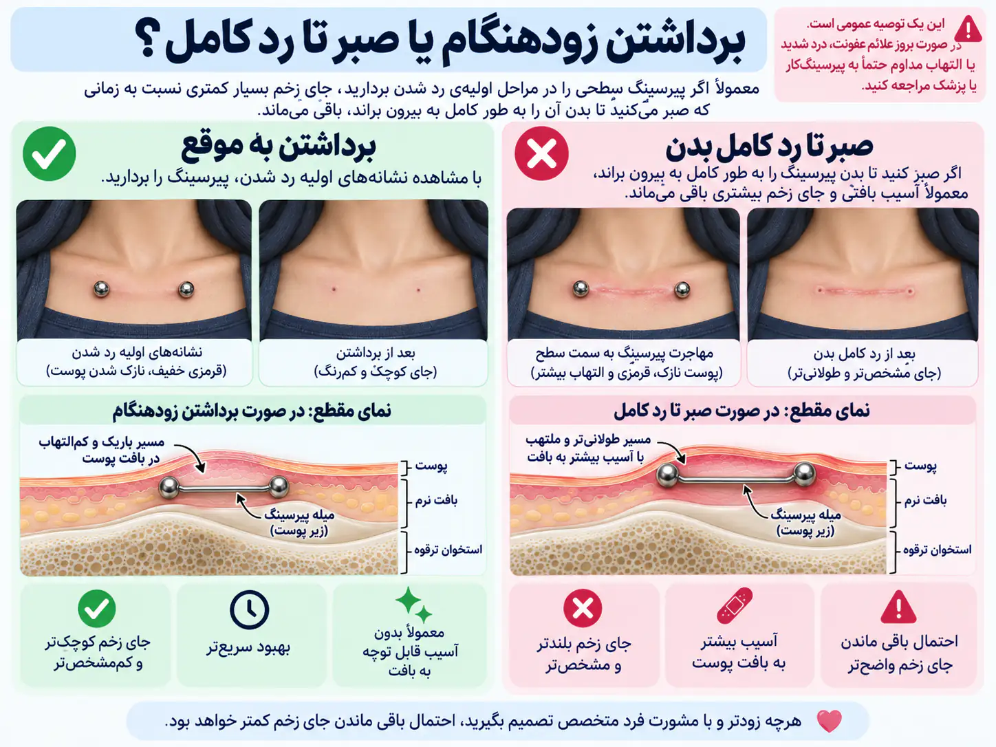 مقایسه‌ی جای زخم پیرسینگ ترقوه در برداشتن زودهنگام و رد کامل بدن