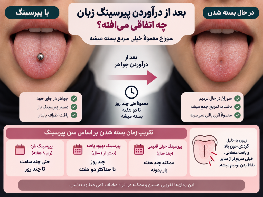 پیرسینگ زبان با گیج بزرگ که احتمال بسته نشدن کامل سوراخ را افزایش می‌دهد