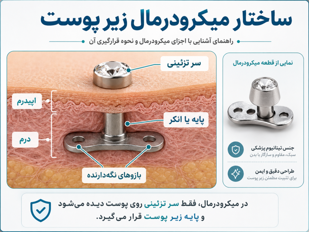ساختار میکرودرمال انکر زیر پوست با بازوهای نگه‌دارنده