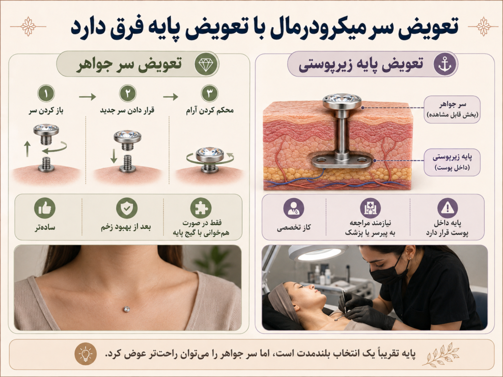 تفاوت جایگزینی سر میکرودرمال با تعویض پایه زیرپوستی