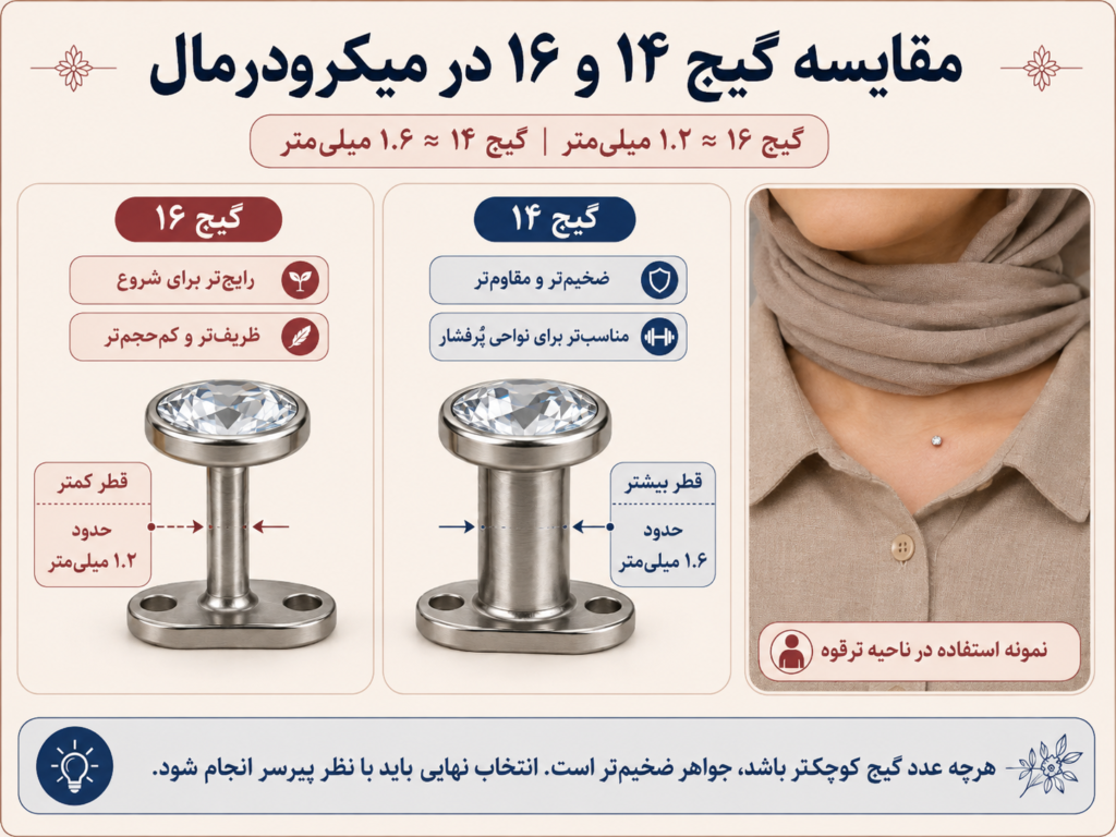مقایسه ضخامت گیج ۱۴ و ۱۶ در میکرودرمال