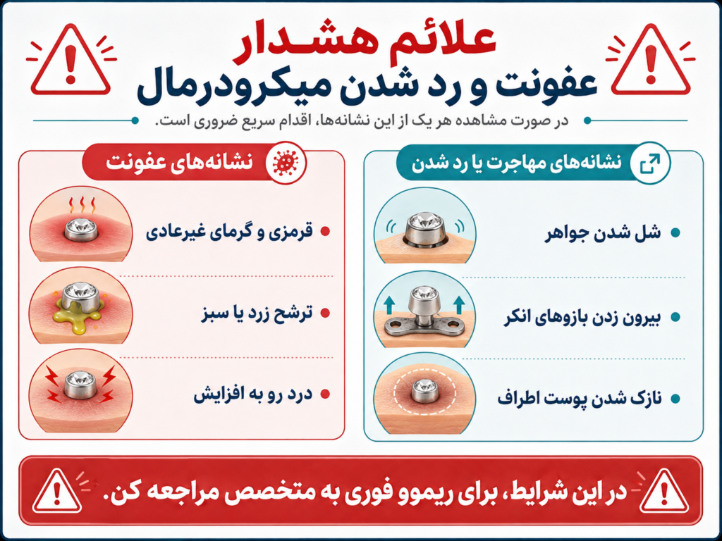 علائم عفونت و رد شدن میکرودرمال که نیاز به ریموو فوری دارد