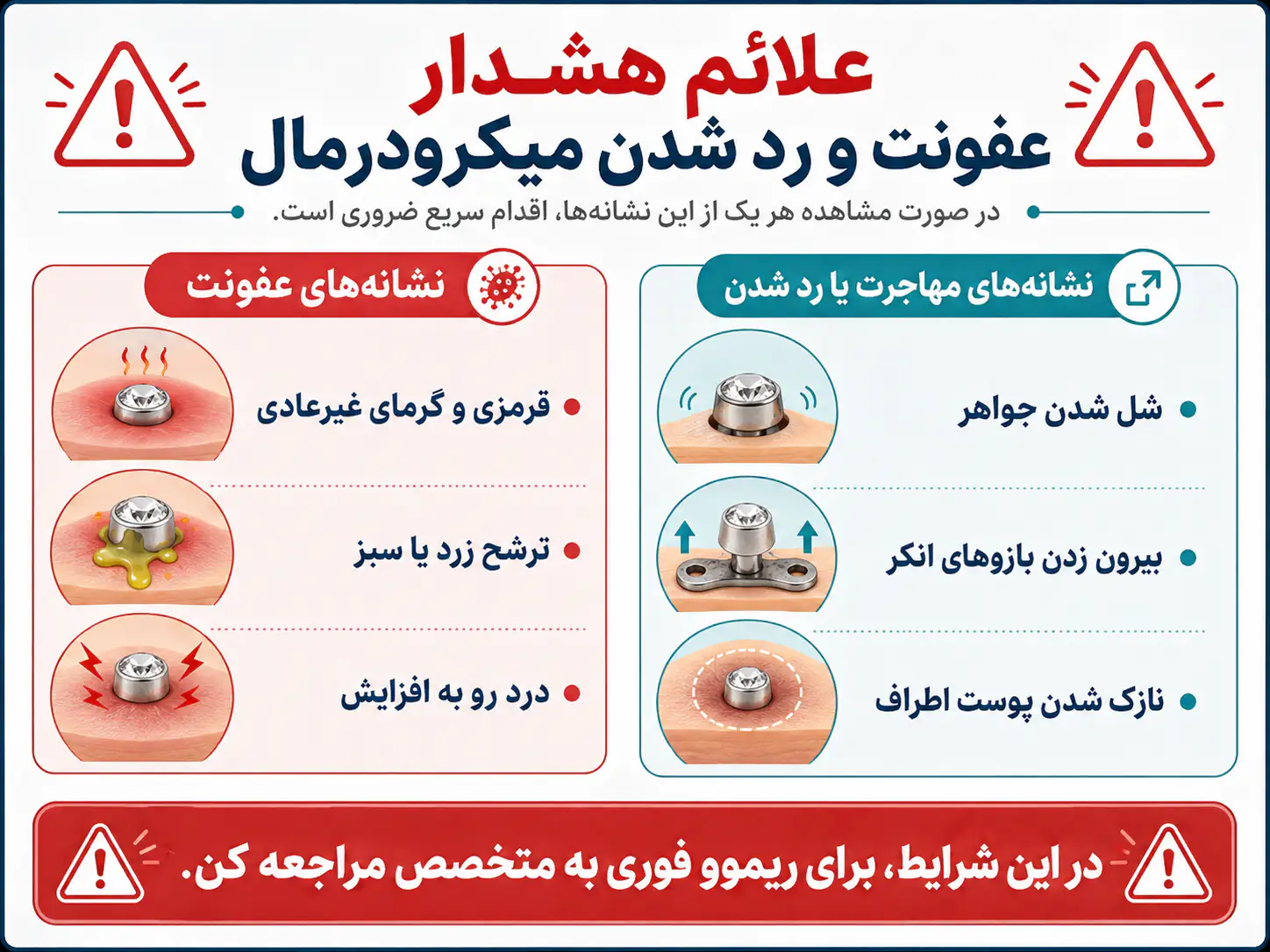 علائم عفونت و رد شدن میکرودرمال که نیاز به ریموو فوری دارد