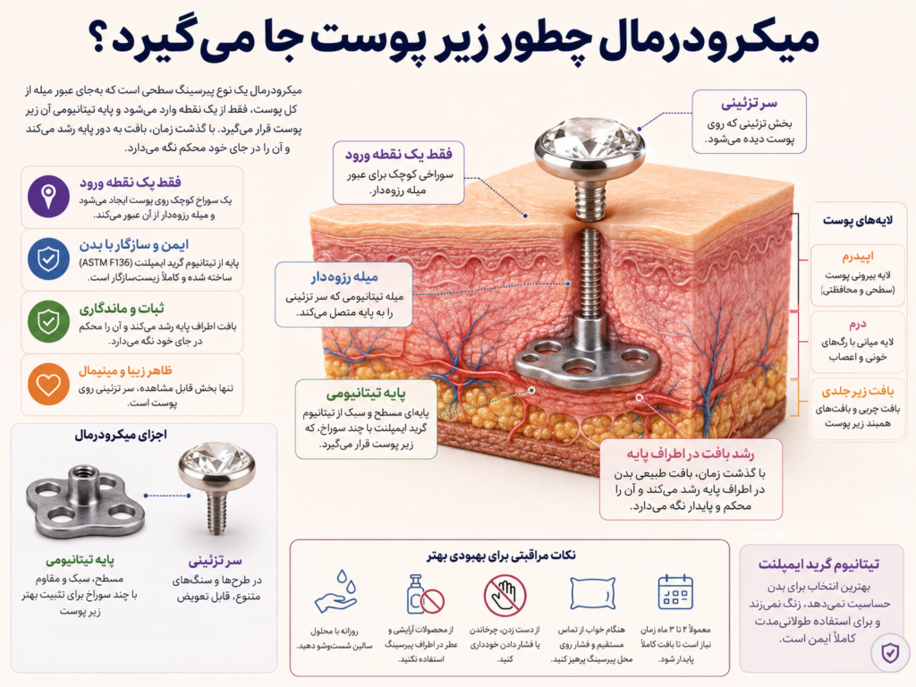 ساختار زیر پوستی پیرسینگ میکرودرمال و پایه تیتانیومی آن