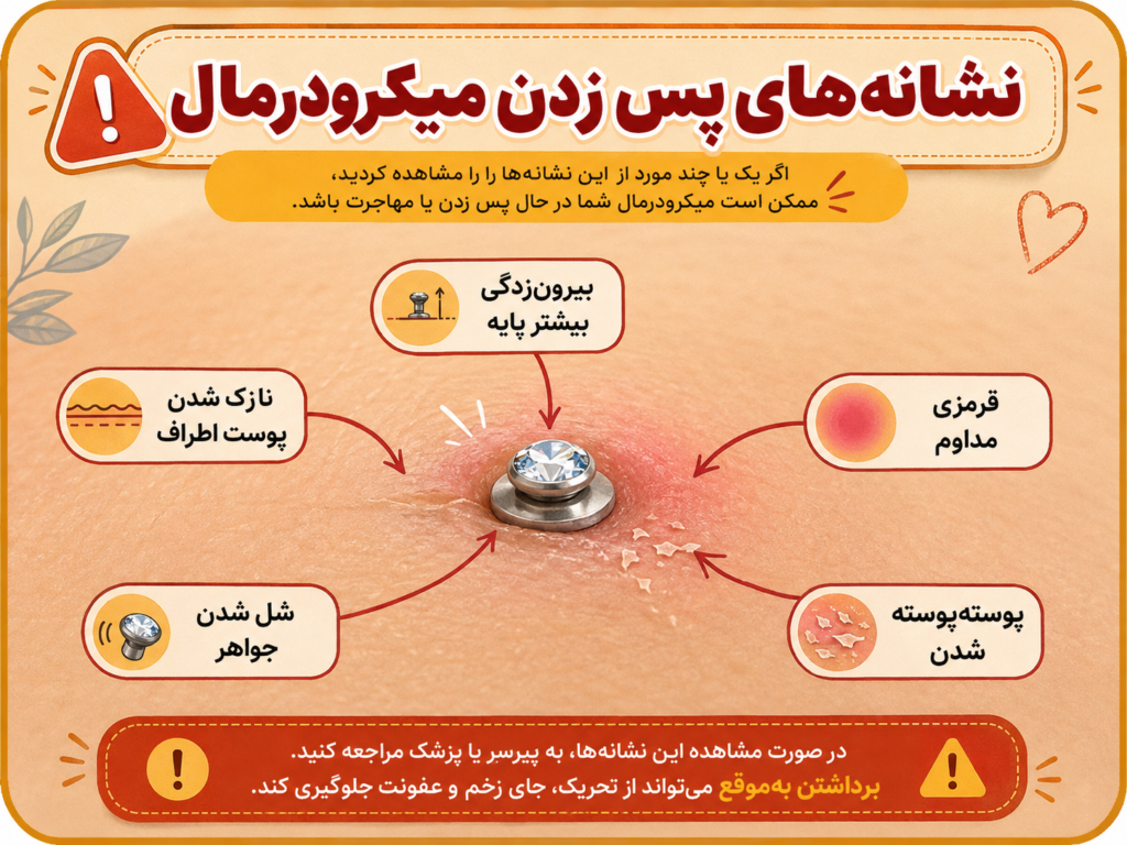 علائم مهاجرت و رد شدن پیرسینگ میکرودرمال زیر پوست