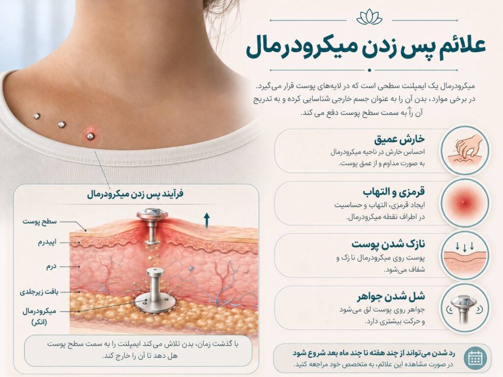علائم رد شدن پیرسینگ میکرودرمال زیر پوست شامل قرمزی و التهاب
