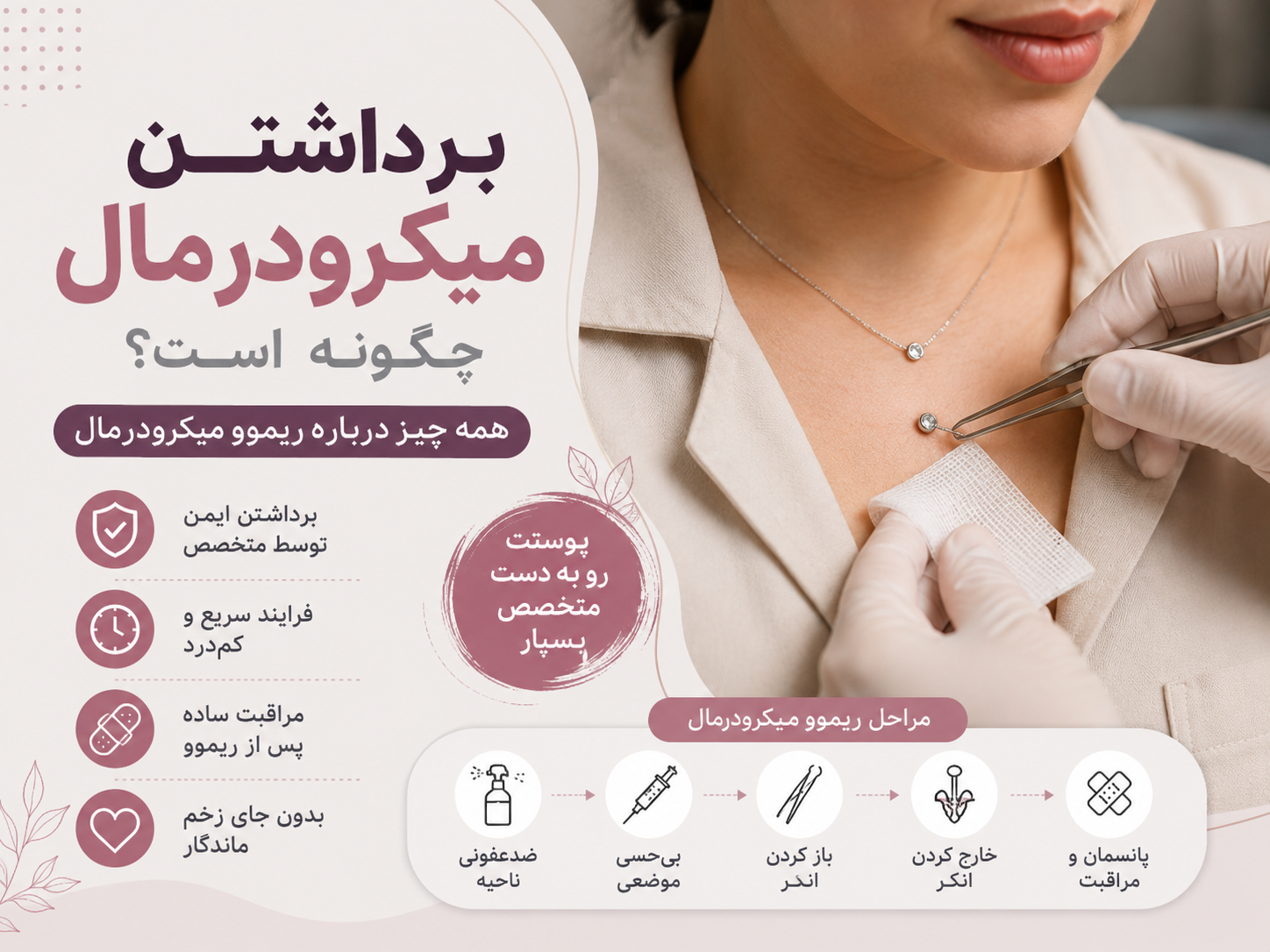 برداشتن میکرودرمال چگونه است؟ همه چیز درباره ریموو میکرودرمال