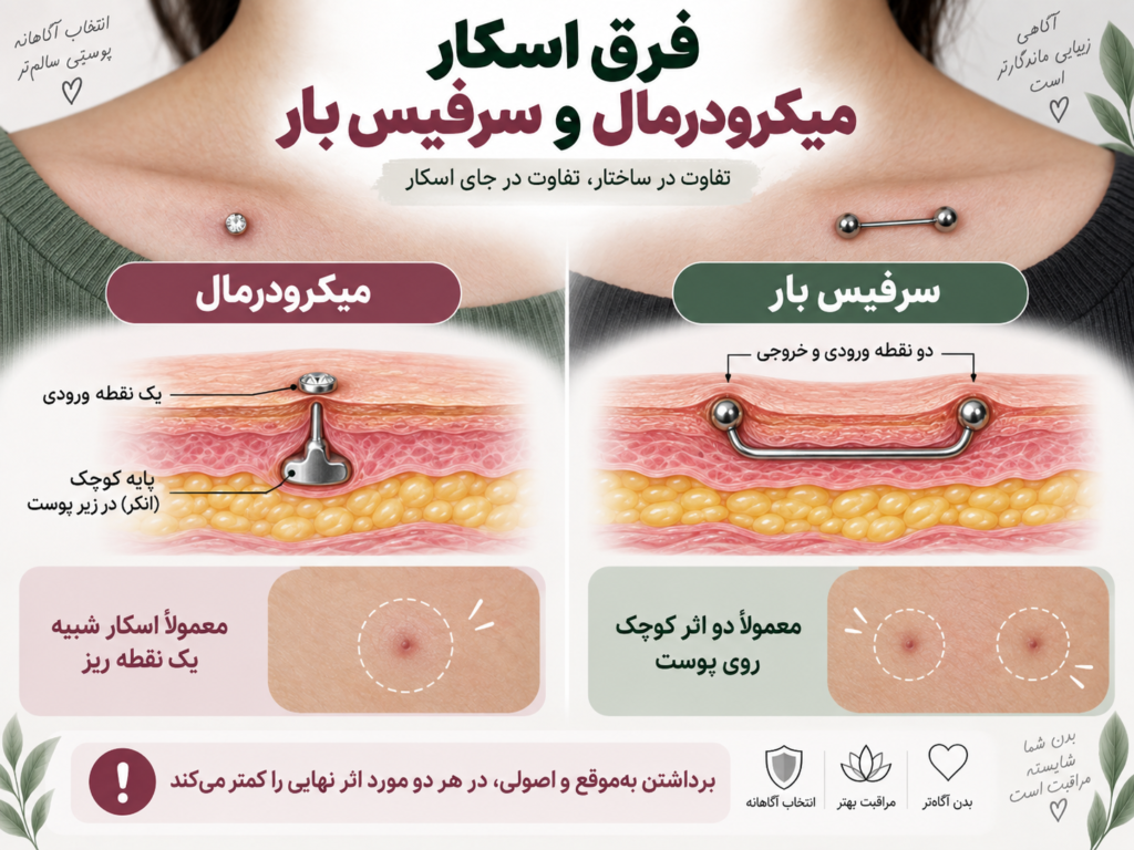 مقایسه ساختار زیرپوستی پیرسینگ میکرودرمال با لنگر و پیرسینگ سرفیس بار با دو نقطه ورودی خروجی