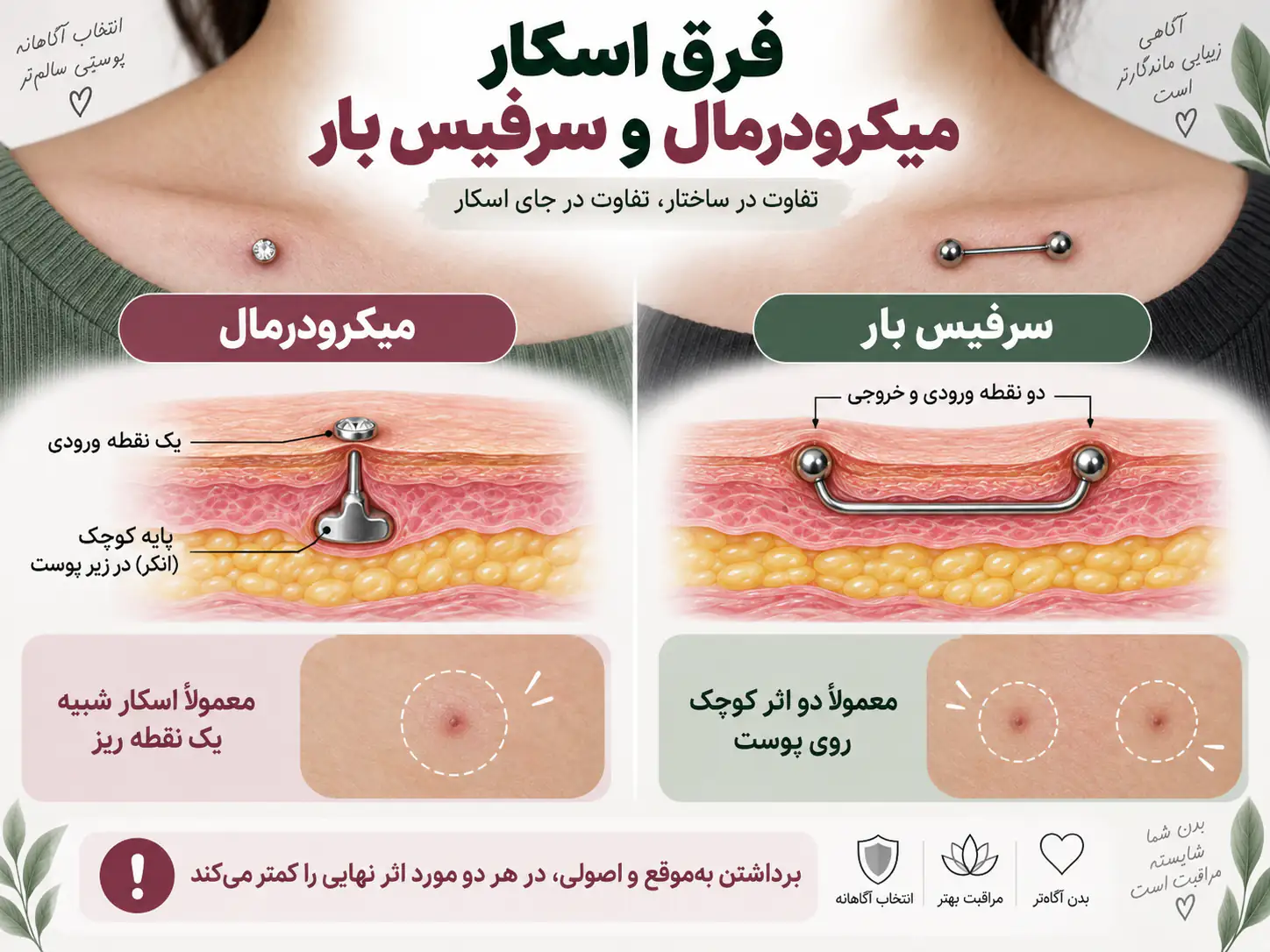 مقایسه ساختار زیرپوستی پیرسینگ میکرودرمال با لنگر و پیرسینگ سرفیس بار با دو نقطه ورودی خروجی