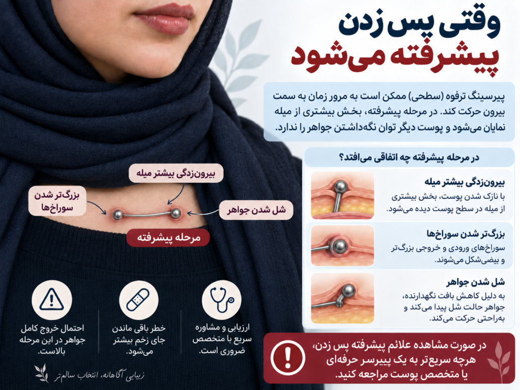 مقایسه میکرودرمال با پیرسینگ سطحی سنتی ترقوه از نظر نحوه اتصال به زیر پوست