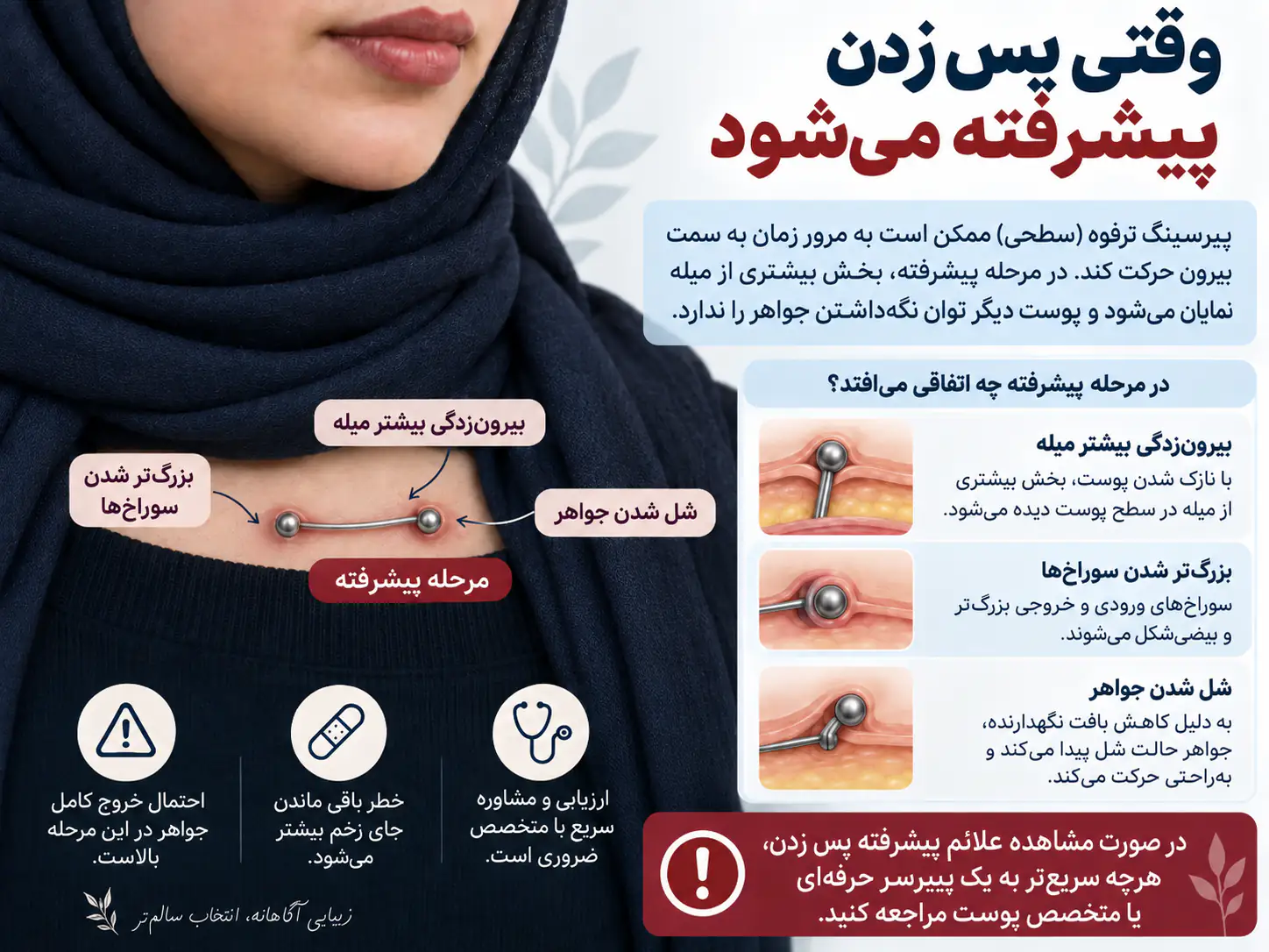 مقایسه میکرودرمال با پیرسینگ سطحی سنتی ترقوه از نظر نحوه اتصال به زیر پوست