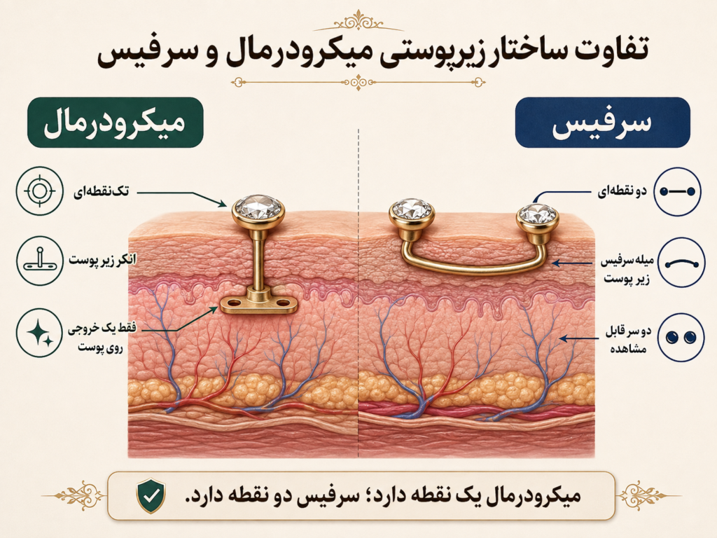 مقایسه ساختار زیرپوستی پیرسینگ میکرودرمال تک‌نقطه‌ای و پیرسینگ سرفیس دو نقطه‌ای
