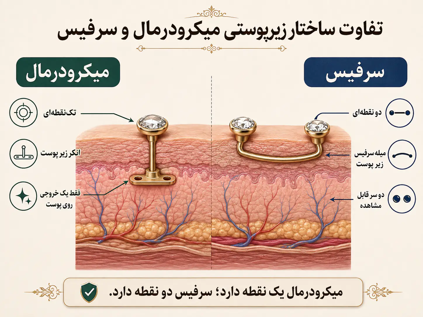 مقایسه ساختار زیرپوستی پیرسینگ میکرودرمال تک‌نقطه‌ای و پیرسینگ سرفیس دو نقطه‌ای