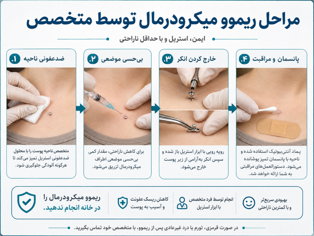 مراحل ریموو میکرودرمال توسط متخصص پیرسینگ با ابزار استریل