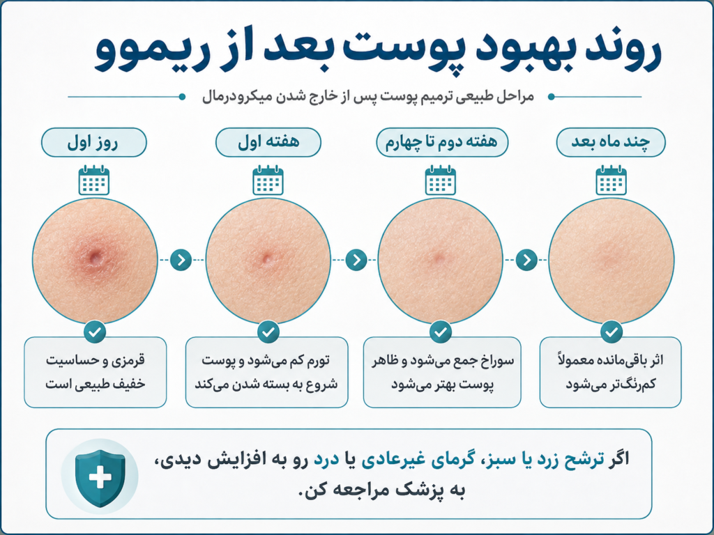 مراحل بهبودی پوست بعد از درآوردن میکرودرمال