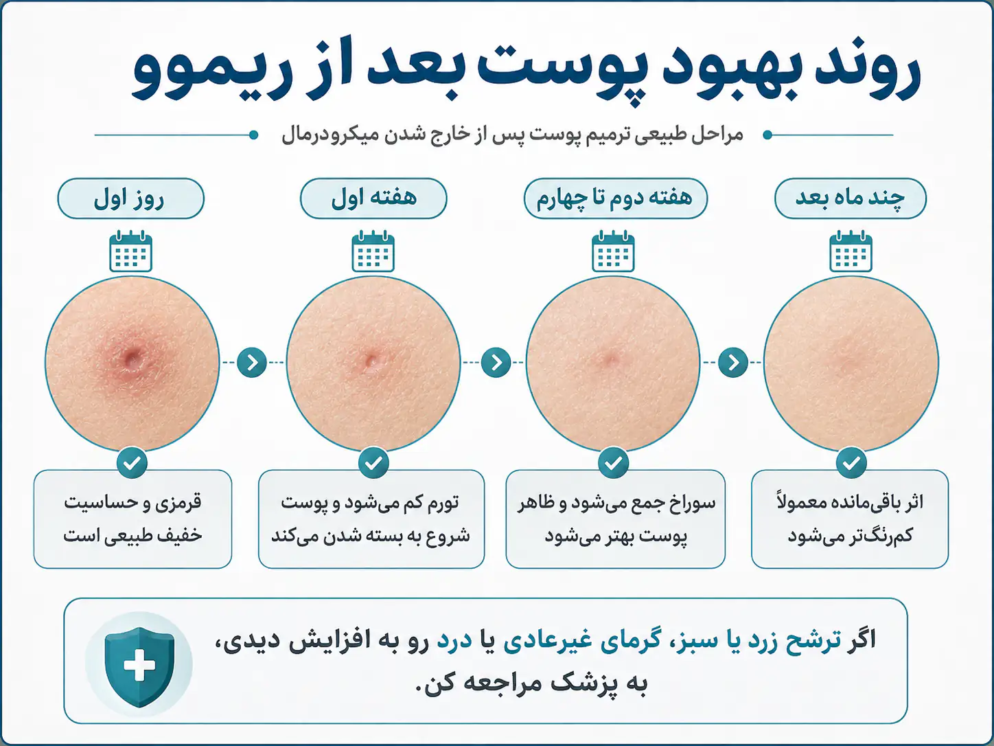 مراحل بهبودی پوست بعد از درآوردن میکرودرمال