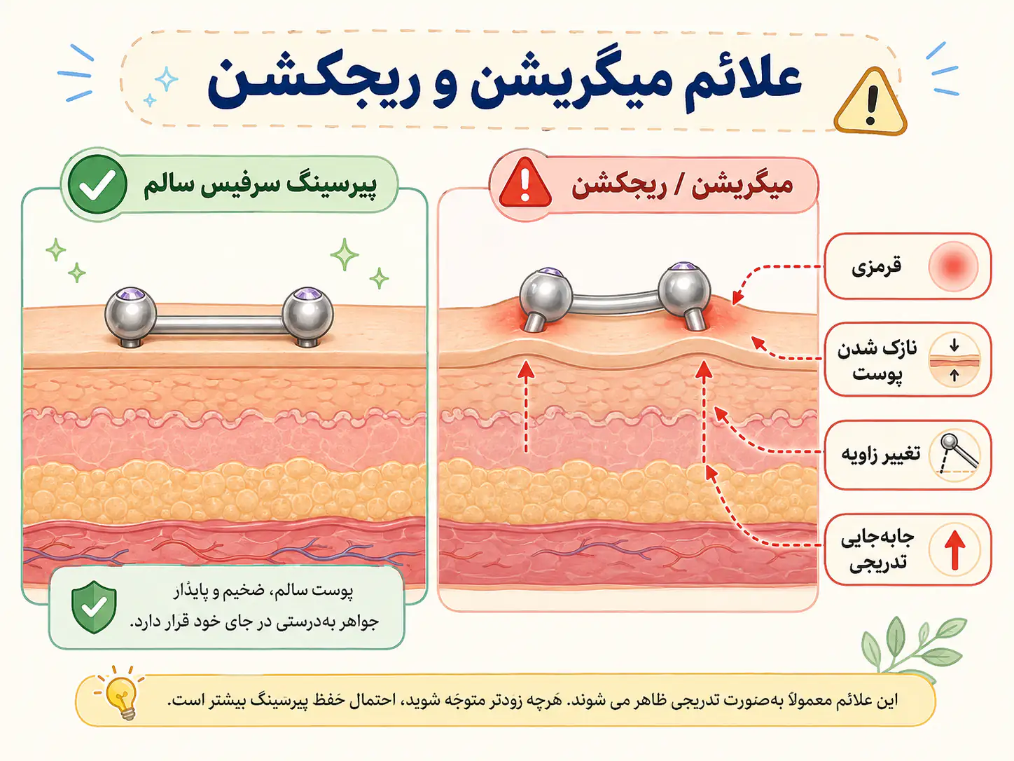 علائم میگریشن و ریجکشن در پیرسینگ سرفیس
