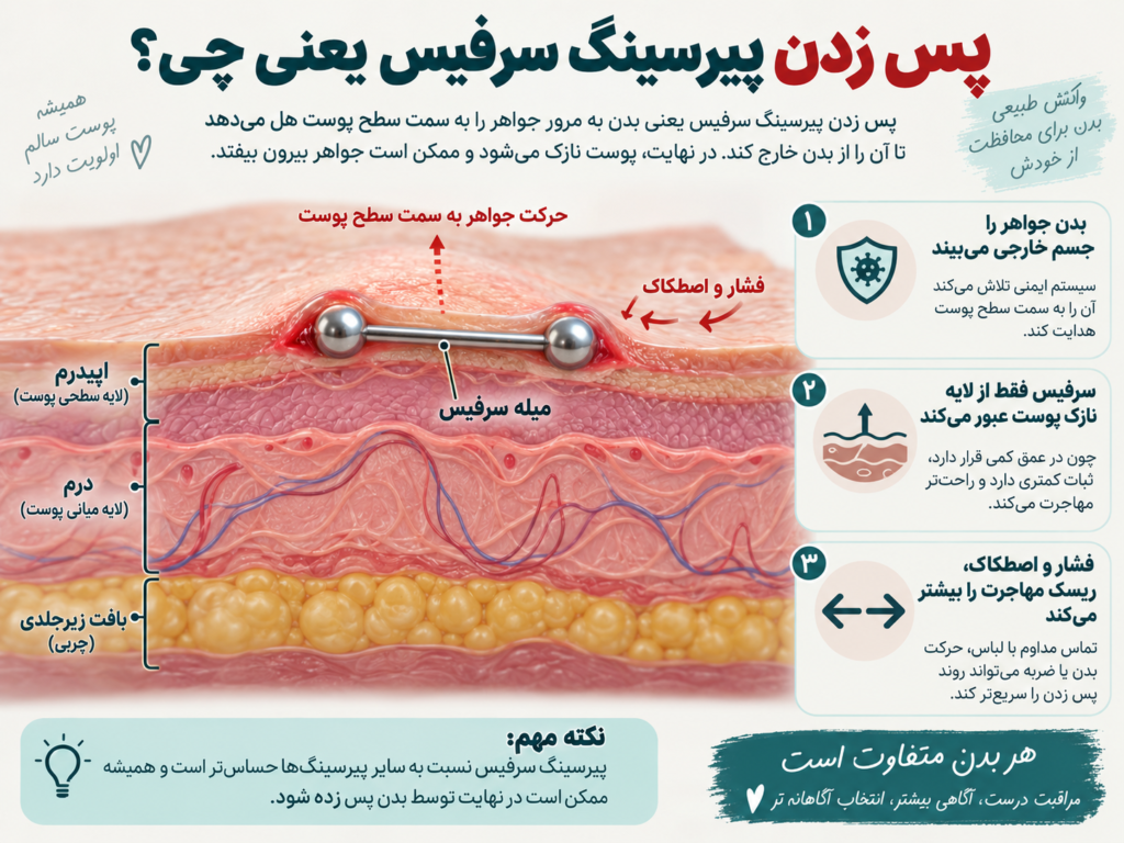 نمایش لایه‌های پوست و جای قرارگیری میله پیرسینگ سرفیس زیر پوست