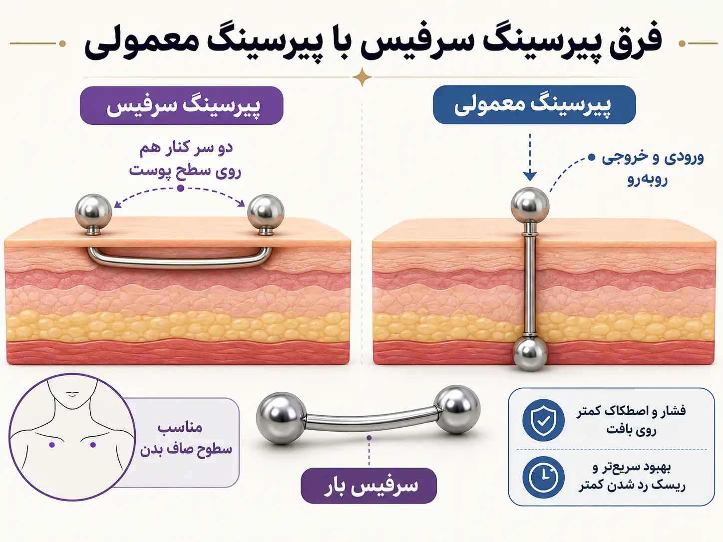 تفاوت پیرسینگ سرفیس با پیرسینگ معمولی و دیاگرام سرفیس بار