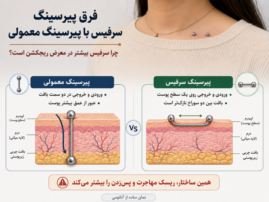 تفاوت آناتومی پیرسینگ سرفیس با پیرسینگ استاندارد