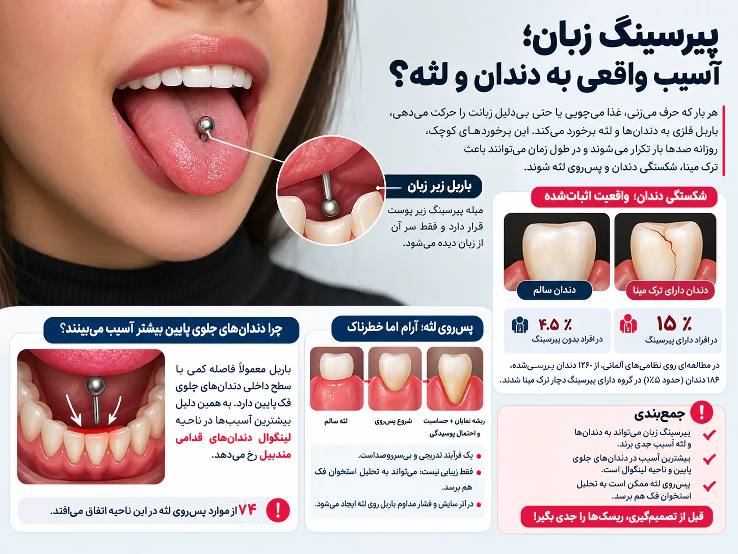 انواع جنس و اندازه بید باربل پیرسینگ زبان و تاثیر آن‌ها بر دندان
