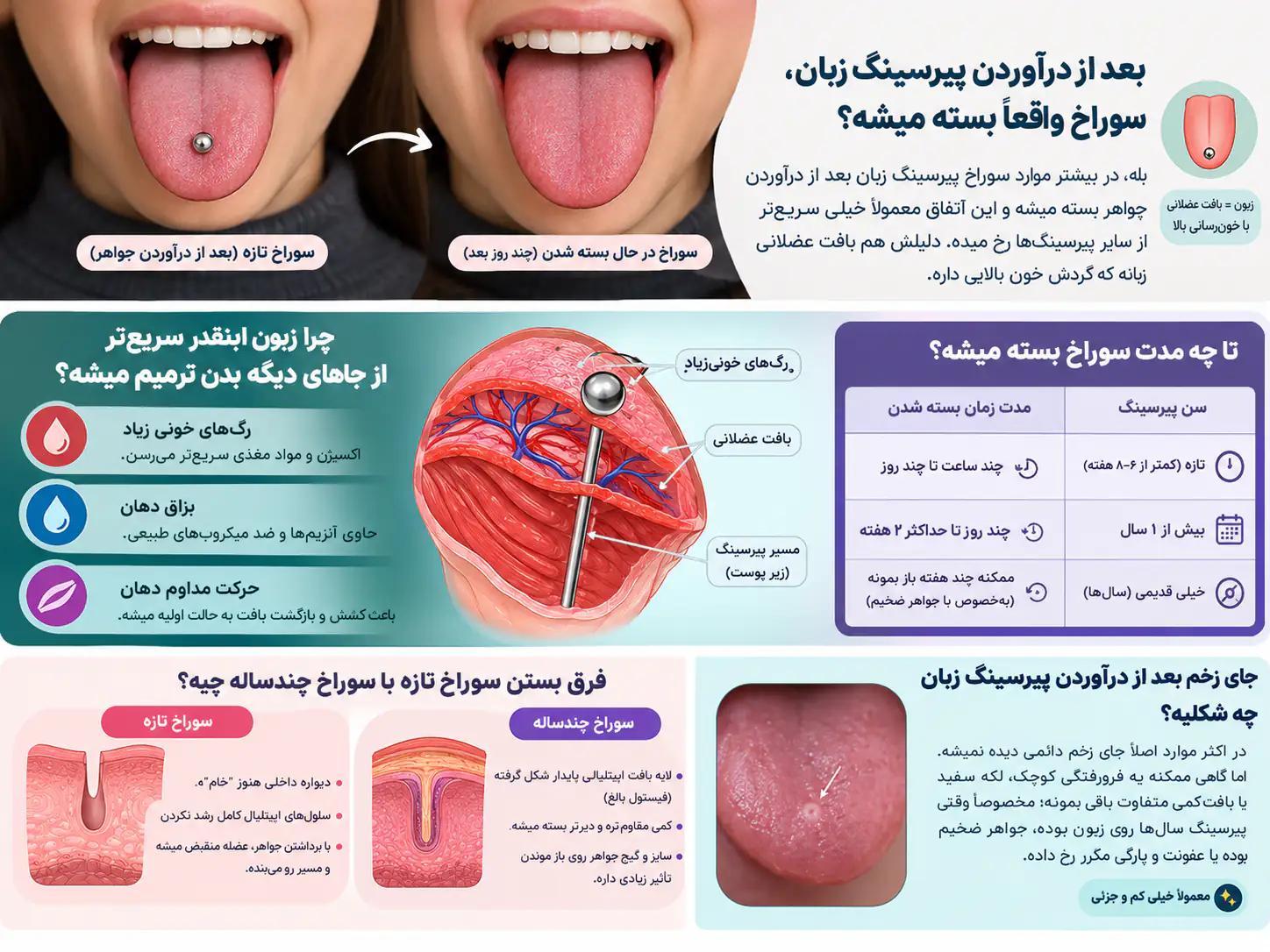 جدول زمانی بسته شدن سوراخ پیرسینگ زبان بر اساس سن پیرسینگ