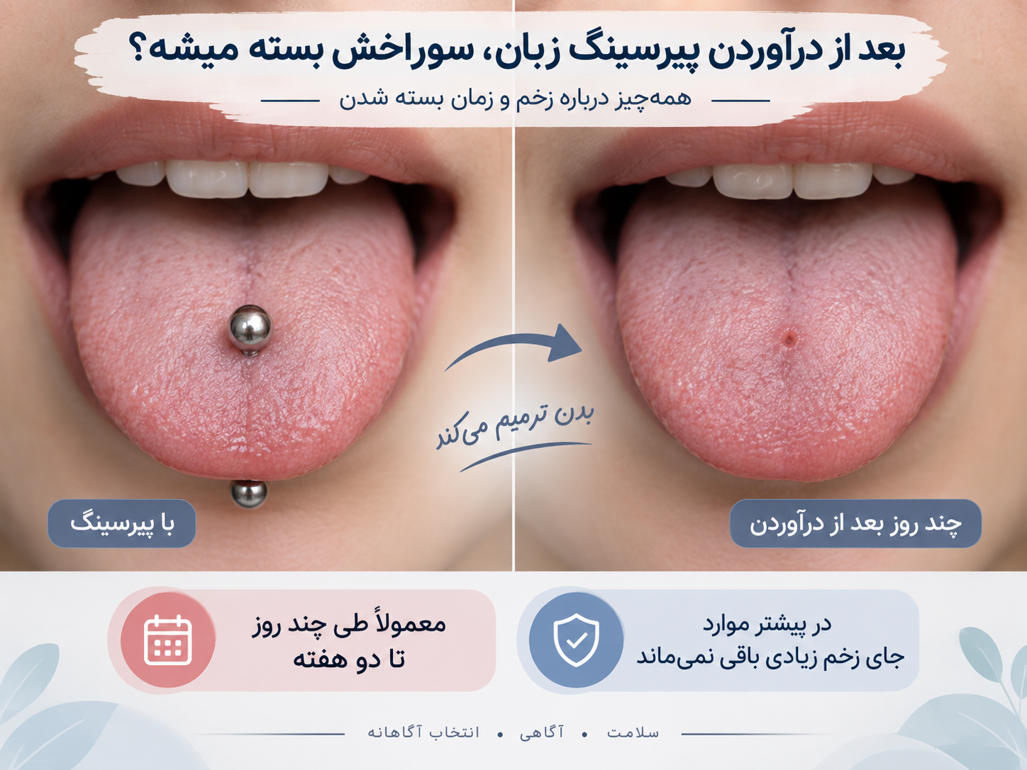 بعد از درآوردن پیرسینگ زبان، سوراخش بسته میشه؟ همه‌چیز درباره زخم و زمان بسته شدن