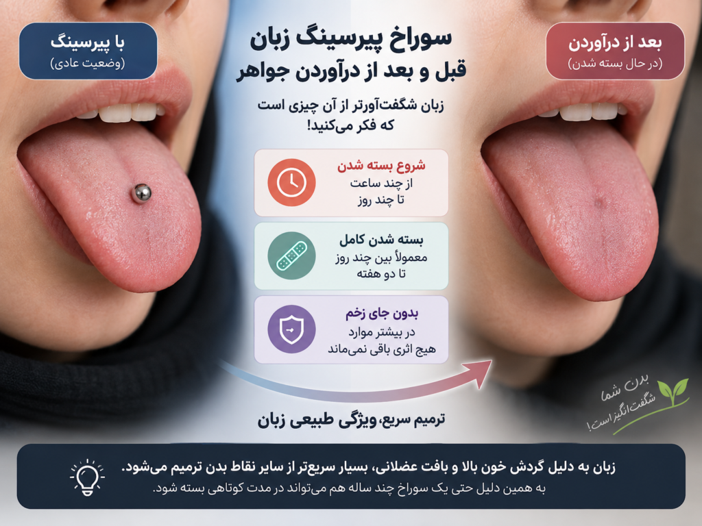 مقایسه سوراخ پیرسینگ زبان تازه باز شده و سوراخ در حال بسته شدن بعد از درآوردن جواهر