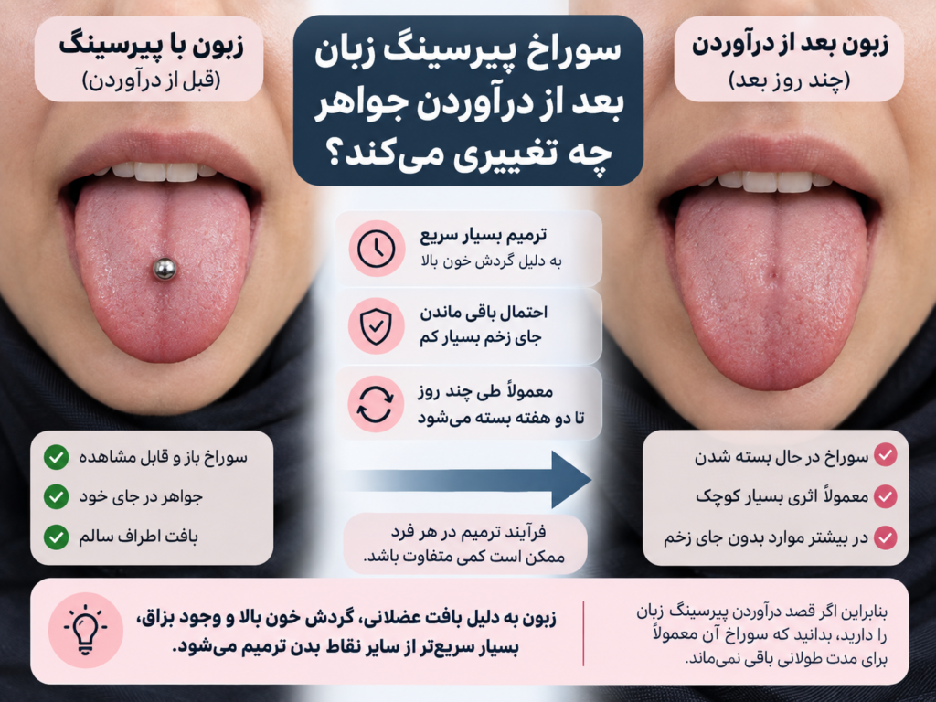 علائم هشدار عفونت بعد از درآوردن پیرسینگ زبان مثل تورم و قرمزی