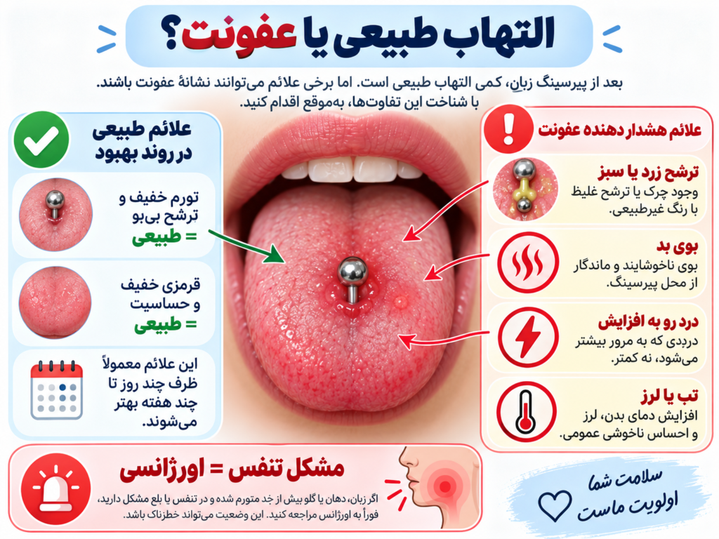 تصویر نزدیک از زبان ملتهب با قرمزی شدید اطراف پیرسینگ به‌عنوان نشانه احتمالی عفونت